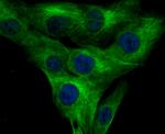 KV4.3 (KCND3) Antibody in Immunocytochemistry (ICC/IF)