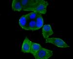 KV4.3 (KCND3) Antibody in Immunocytochemistry (ICC/IF)