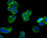 KV4.3 (KCND3) Antibody in Immunocytochemistry (ICC/IF)