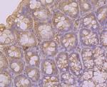 KCNK4 Antibody in Immunohistochemistry (Paraffin) (IHC (P))