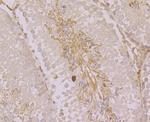 ORAI3 Antibody in Immunohistochemistry (Paraffin) (IHC (P))