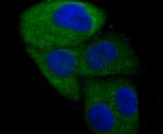 N-WASP Antibody in Immunocytochemistry (ICC/IF)