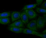 N-WASP Antibody in Immunocytochemistry (ICC/IF)