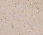 N-WASP Antibody in Immunohistochemistry (Paraffin) (IHC (P))