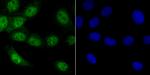 VDR Antibody in Immunocytochemistry (ICC/IF)