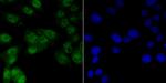 VDR Antibody in Immunocytochemistry (ICC/IF)