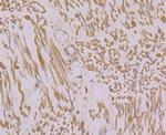 RyR1 Antibody in Immunohistochemistry (Paraffin) (IHC (P))