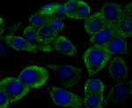 Ryanodine Receptor Antibody in Immunocytochemistry (ICC/IF)