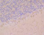 Ryanodine Receptor Antibody in Immunohistochemistry (Paraffin) (IHC (P))