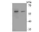 CACNB3 Antibody in Western Blot (WB)