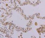 KIF11 Antibody in Immunohistochemistry (Paraffin) (IHC (P))