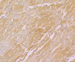 CACNB1 Antibody in Immunohistochemistry (Paraffin) (IHC (P))