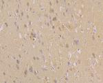 CACNB1 Antibody in Immunohistochemistry (Paraffin) (IHC (P))