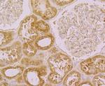 CACNB1 Antibody in Immunohistochemistry (Paraffin) (IHC (P))