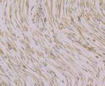 CACNB1 Antibody in Immunohistochemistry (Paraffin) (IHC (P))