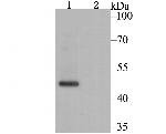 CACNB1 Antibody in Western Blot (WB)