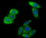 HKDC1 Antibody in Immunocytochemistry (ICC/IF)