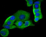 HKDC1 Antibody in Immunocytochemistry (ICC/IF)