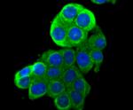 HKDC1 Antibody in Immunocytochemistry (ICC/IF)