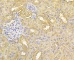 HKDC1 Antibody in Immunohistochemistry (Paraffin) (IHC (P))