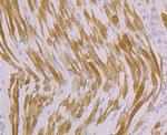 ATP2A1 Antibody in Immunohistochemistry (Paraffin) (IHC (P))