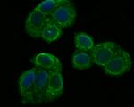 PHF8 Antibody in Immunocytochemistry (ICC/IF)