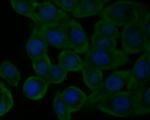 CaV2.3 Antibody in Immunocytochemistry (ICC/IF)