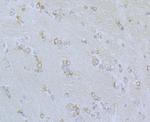 CaV2.3 Antibody in Immunohistochemistry (Paraffin) (IHC (P))