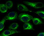 CaV1.2 Antibody in Immunocytochemistry (ICC/IF)