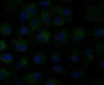 MCU Antibody in Immunocytochemistry (ICC/IF)