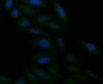 alpha Actinin 1 Antibody in Immunocytochemistry (ICC/IF)