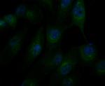 alpha Actinin 1 Antibody in Immunocytochemistry (ICC/IF)