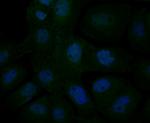 alpha Actinin 1 Antibody in Immunocytochemistry (ICC/IF)