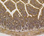 alpha Actinin 1 Antibody in Immunohistochemistry (Paraffin) (IHC (P))