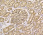 alpha Actinin 1 Antibody in Immunohistochemistry (Paraffin) (IHC (P))