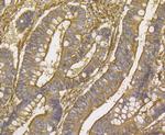 alpha Actinin 1 Antibody in Immunohistochemistry (Paraffin) (IHC (P))