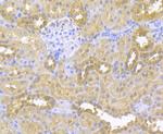 gamma-ENaC Antibody in Immunohistochemistry (Paraffin) (IHC (P))