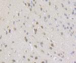 gamma-ENaC Antibody in Immunohistochemistry (Paraffin) (IHC (P))