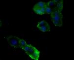 Nephrin Antibody in Immunocytochemistry (ICC/IF)