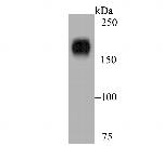 Nephrin Antibody in Western Blot (WB)