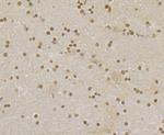 RAD21 Antibody in Immunohistochemistry (Paraffin) (IHC (P))