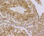 RAD21 Antibody in Immunohistochemistry (Paraffin) (IHC (P))