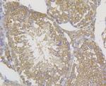 CD99 Antibody in Immunohistochemistry (Paraffin) (IHC (P))