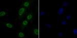 GPR30 Antibody in Immunocytochemistry (ICC/IF)