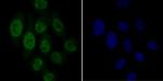 GPR30 Antibody in Immunocytochemistry (ICC/IF)