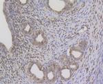 GPR30 Antibody in Immunohistochemistry (Paraffin) (IHC (P))