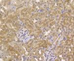 GPR30 Antibody in Immunohistochemistry (Paraffin) (IHC (P))