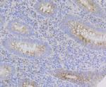 GPR30 Antibody in Immunohistochemistry (Paraffin) (IHC (P))