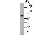 GPR30 Antibody in Western Blot (WB)