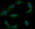 TRPA1 Antibody in Immunocytochemistry (ICC/IF)